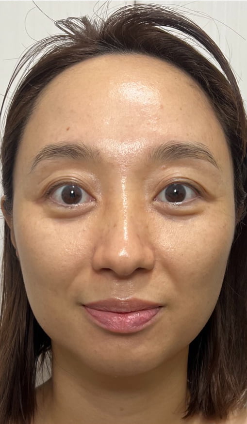 脳醒律™ 骨格美顔デザイン 100分 After